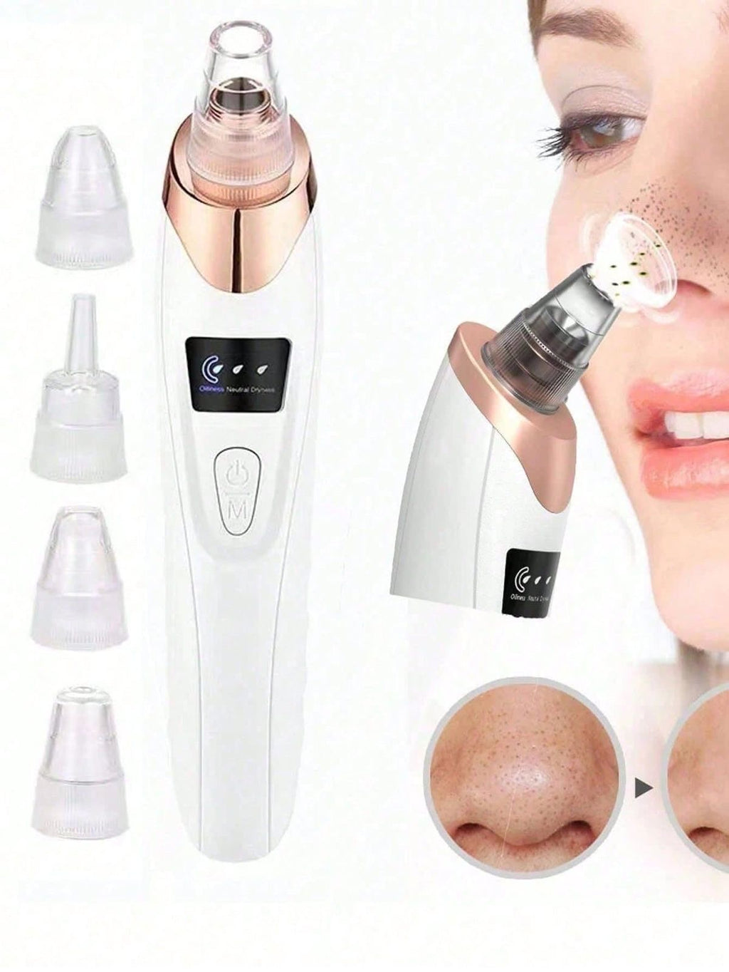 Blackhead Remover & Pore Cleanser - With 4 Suction Heads
