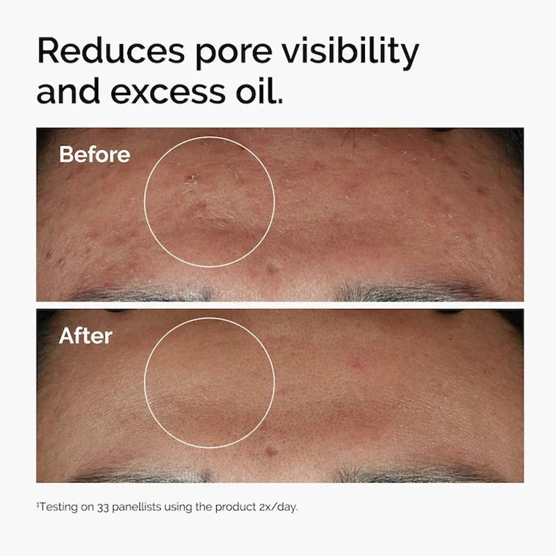 The Ordinary Korean Niacinamide